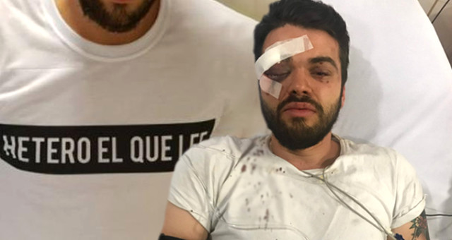 Homoseksual idmançını vəhşicəsinə döyüldü - FOTO