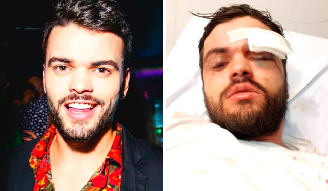 Homoseksual idmançını vəhşicəsinə döyüldü - FOTO