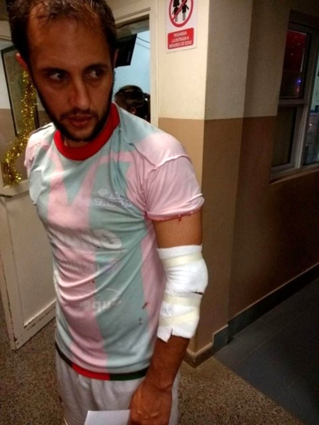 Polis plastik mərmilərlə futbolçuları vurdu - FOTOLAR