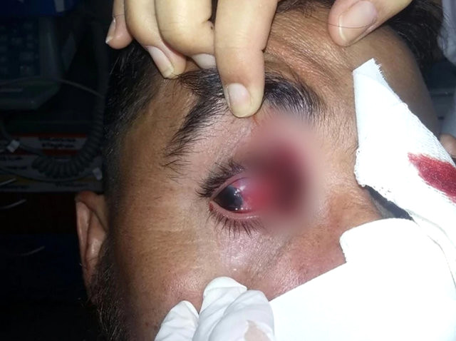 Polis plastik mərmilərlə futbolçuları vurdu - FOTOLAR