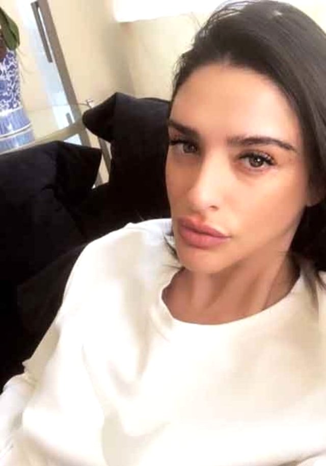 Ardanın arvadı estetik etdirdi, gülüş hədəfinə çevirildi - FOTO