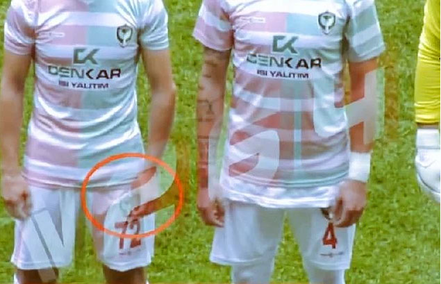 Futbolçu oyun zamanı ülgüclə rəqiblərinə xəsarət yetirdi - FOTO/VİDEO