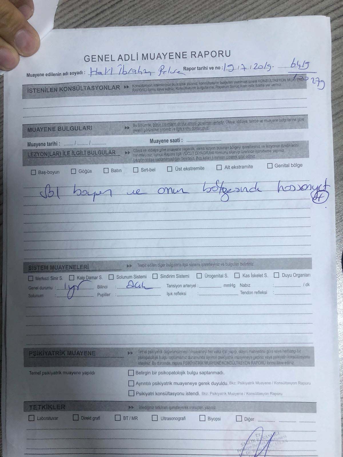 Prezidentin mühafizəçisi futbolçunu vəhşicəsinə döydü - FOTOLAR