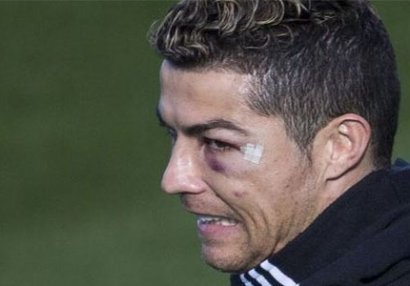 Ronaldo tanınmaz hala düşdü - FOTO