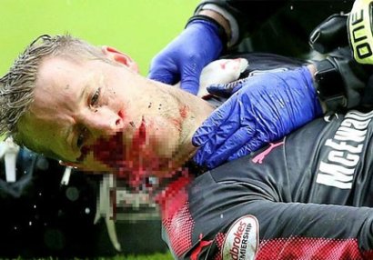 Futbolçu meydanda qana boyandı - FOTOLAR
