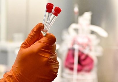 Fransa klublarında koronavirus şoku