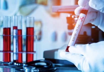 Futbol hakimlərində koronavirus aşkarlandı