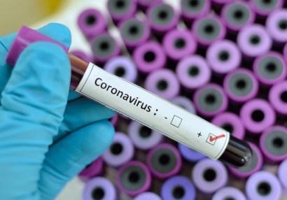 Klublarımızın koronavirus testlərinin nəticəsi açıqlandı