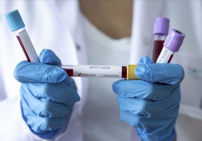 Milliyə dəvət futbolçularda koronavirus aşkar edildi