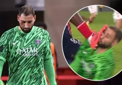 PSJ qələbə qazandı, Donnarumma meydanı qan içində tərk etdi - FOTO
