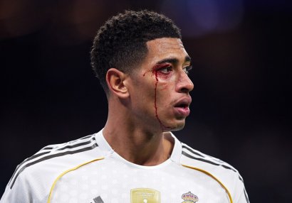 "Real Madrid"in ulduzu uzun müddətə sıradan çıxdı