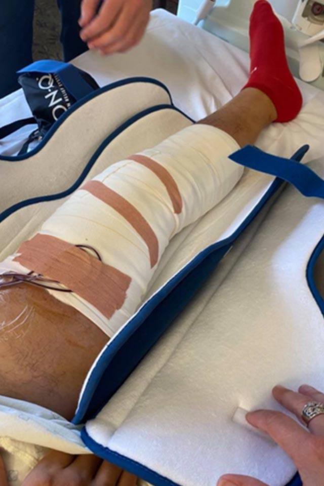 Nadir görülən xəstəliyə tutuldu, karyerasını və ayağını itirdi - FOTO