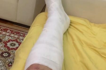 Azərbaycanlı müğənni futbol oynadı, ayağını sındırdı - FOTO/VİDEO