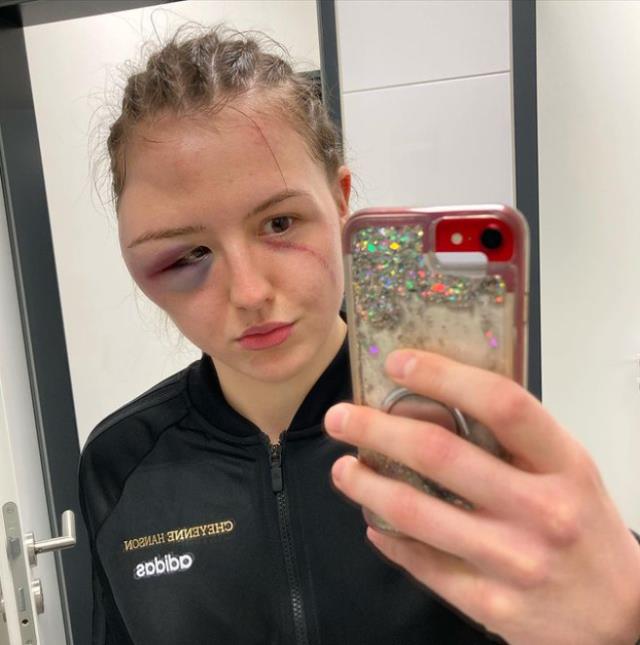 Xanım boksçu rinqdə tanınmaz hala düşdü - FOTO
